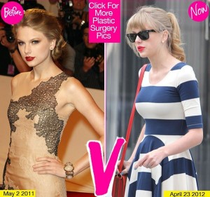 Taylor Swift aumento seno